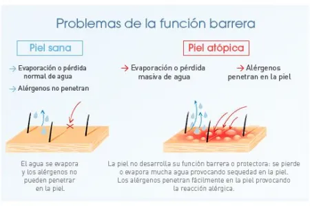 Esquema problema de la barrera cutánea